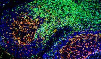 Immunofluorescence staining of CD3 and PD1 proteins in a tonsil tissue section.