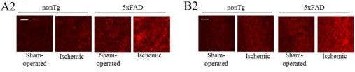 Immunohistochemical staining of 4-Hydroxynonenal (HNE) in mouse brain tissue.