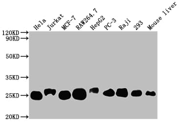 Tctp Antibody 10a9 Ab314167  Western Blot Img419505