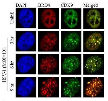 Immunocytochemical analysis of HeLa cells showing co-localization of BRD4 (red) with CDK9 (green) following HSV-1 infection.