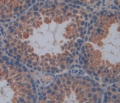 Anti-SDF2L1 antibody(ab231797)