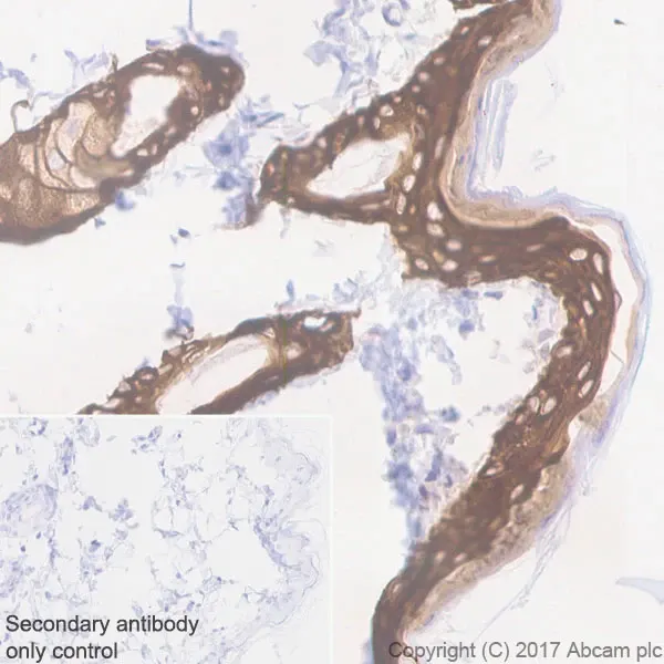 Immunohistochemistry of rat skin tissue stained for Cytokeratin 5