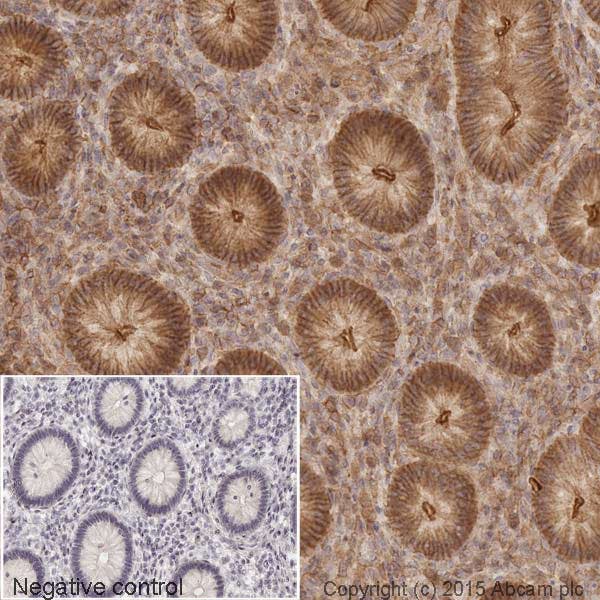 IHC image of beta-Actin staining in normal human colon tissue, counterstained with haematoxylin.
