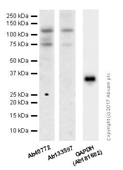 Anti-E Cadherin antibody [EP700Y] - Intercellular Junction Marker(AB40772)