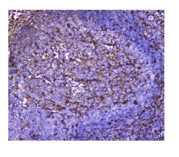 Galectin 1 Antibody Ab112525  Immunohistochemistry Formalin Pfa Fixed Paraffin Embedded Sections Img40300