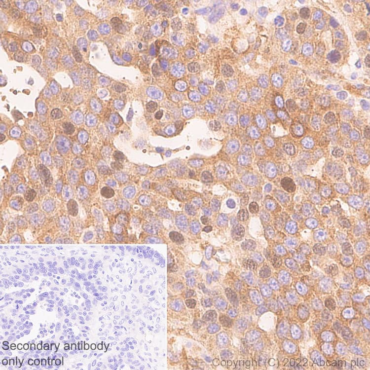 Anti-NF-kB p65 antibody [E379] - Mouse IgG2a (Chimeric)(AB307840)