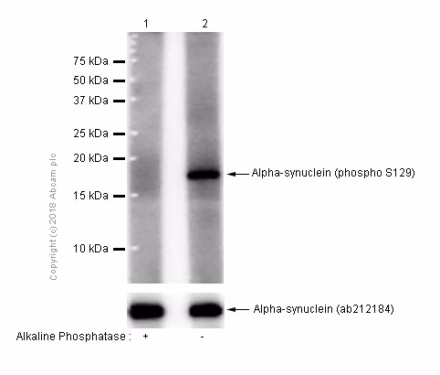 Western blot showing phospho-alpha-synuclein (S129) expression in mouse brain lysates.