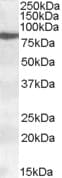 15 Lipoxygenase 1 Antibody Ab80495  Western Blot Img100084