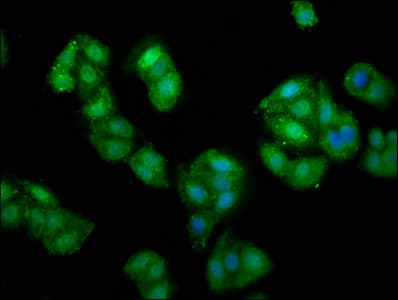 Prune Antibody Ab237518  Immunocytochemistry Immunofluorescence Img71057