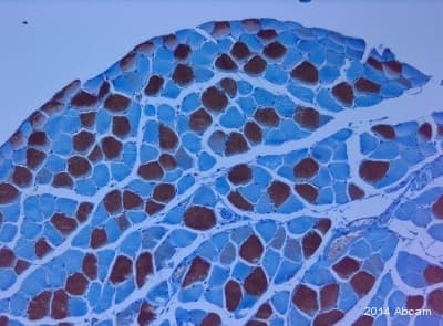 Anti-Slow Skeletal Myosin Heavy chain antibody [NOQ7.5.4D](AB11083)