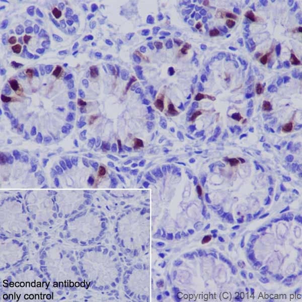 Cyclin A2 Antibody Epr17351 Bsa And Azide Free Ab231164  Immunohistochemistry Formalin Pfa Fixed Paraffin Embedded Sections Img83803