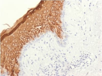 Anti-Cytokeratin 10 antibody [KRT10/1948R](AB234313)
