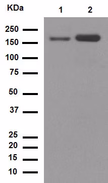 Western blot of anti-CD11b antibody (ab133357) at 1/1000 dilution on TF-1 and TPA treated THP-1 cell lysates.