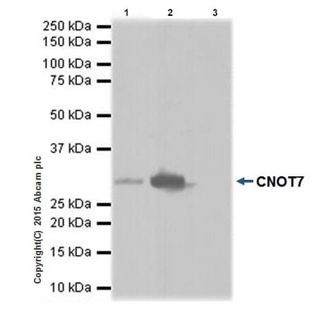 Anti-CNOT7 antibody [EPR18722](AB195587)