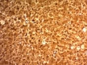 Liver Arginase Antibody Arg1 1126 Ab215894  Immunohistochemistry Formalin Pfa Fixed Paraffin Embedded Sections Img132283
