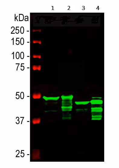 Western blot analysis of GFAP expression in rat and mouse brain and spinal cord lysates. Lanes 1-4 show lysates from rat brain, rat spinal cord, mouse brain, and mouse spinal cord, respectively. The predicted band size for GFAP is 49 kDa.