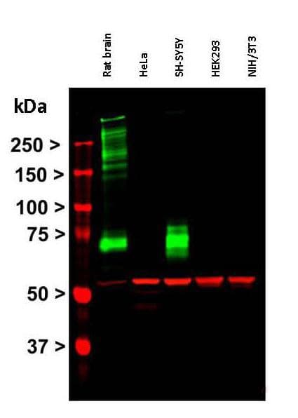Anti-Vimentin antibody(AB24525)