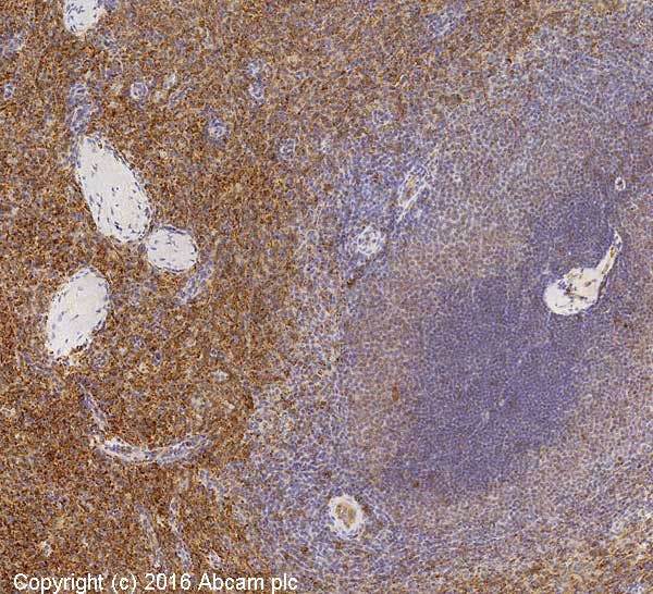 CD31 staining IHC in human spleen tissue section, fixed and embedded, using Leica Bond™ system, standard protocol F.