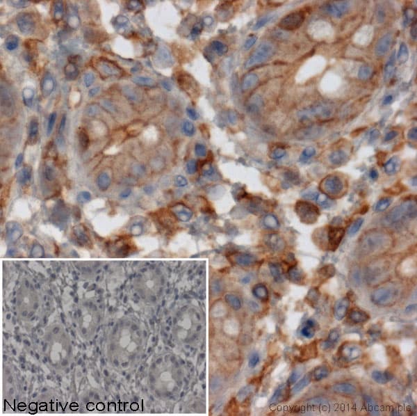 Mouse monoclonal [SB62a] Anti-Rabbit IgG light chain (HRP)(AB99697)