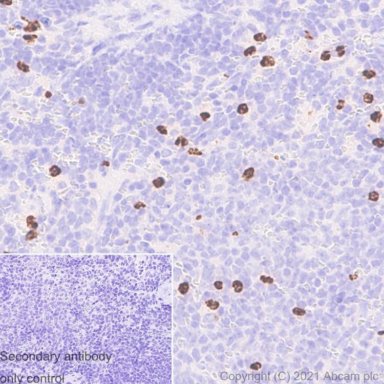 Anti-MMP9 antibody [RM1020](AB283575)