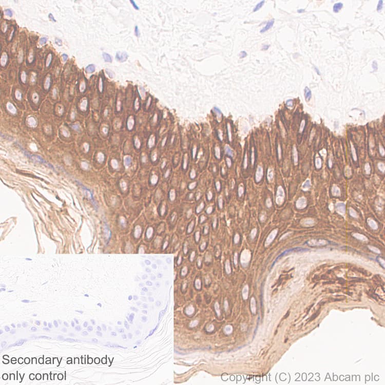 Pan Cytokeratin Antibody Epr28285 45 Bsa And Azide Free Ab308263  Immunohistochemistry Formalin Pfa Fixed Paraffin Embedded Sections Img408890