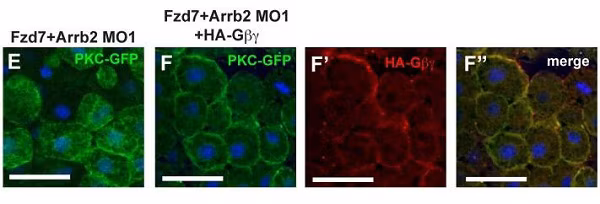 Immunocytochemistry image showing anti-HA tag antibody (ChIP Grade ab9110) illustrating Arrb2's role in PKCα translocation.