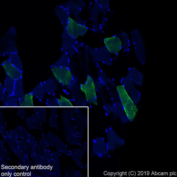 Anti-Slow Skeletal Myosin Heavy chain antibody [EPR22697-17](AB234431)