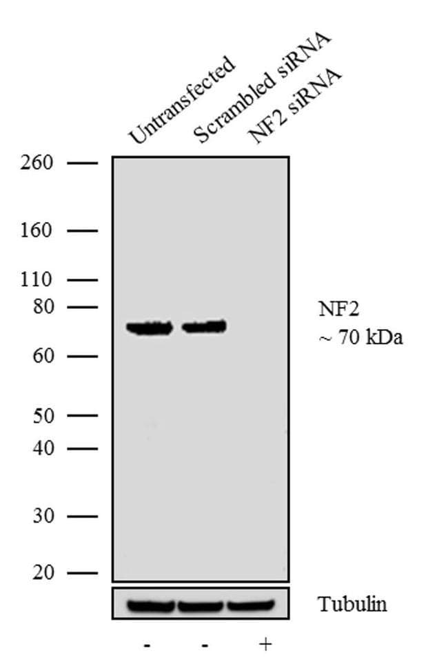 Anti-NF2 / Merlin antibody [RP23040199](AB308025)