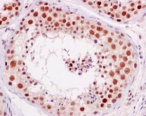 Anti-PBK/SPK (phospho T9) antibody [EPR2475(N)](AB184953)