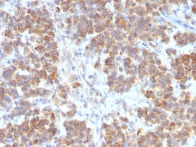 Anti-TL1A antibody [VEGI/2052R](AB234307)