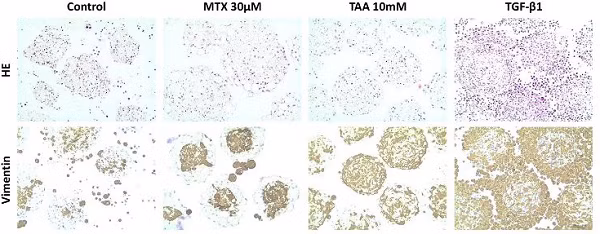 Immunostaining of formalin fixed paraffin embedded human microtissues after exposure to MTX, TAA and TGF-β1
