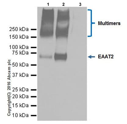 Anti-EAAT2 antibody [EPR19794](AB205247)