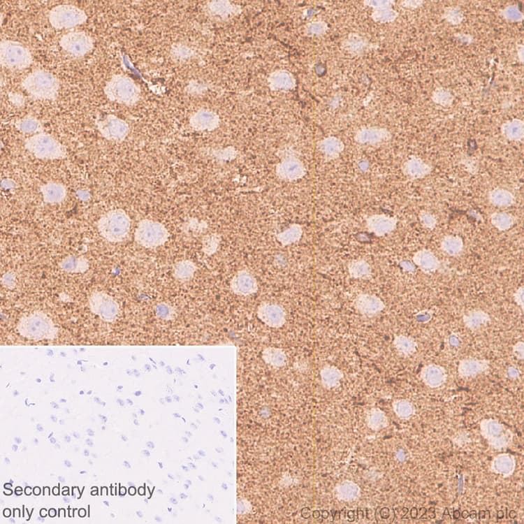Marcks Antibody Epr28261 90 Bsa And Azide Free Ab315026  Immunohistochemistry Formalin Pfa Fixed Paraffin Embedded Sections Img423773