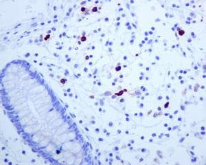 Anti-Mast Cell Tryptase antibody [EPR8475](AB134931)