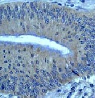 Bcl10 Antibody Ep605y Bsa And Azide Free Ab189218  Immunohistochemistry Formalin Pfa Fixed Paraffin Embedded Sections Img109717