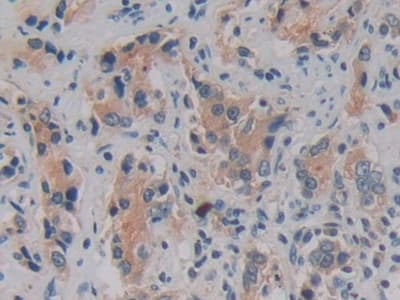 Anti-Kallikrein 2/KLK2 antibody(ab232980)