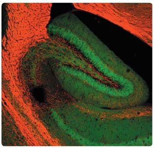 Anti-Myelin Basic Protein antibody(AB134018)
