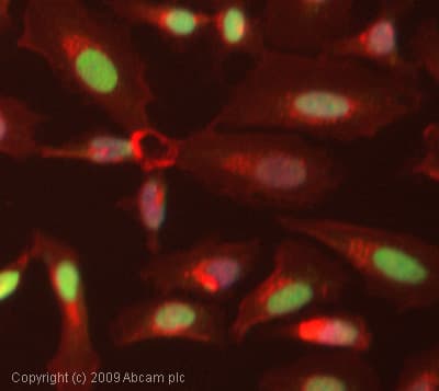 Anti-SREBP2 antibody(AB30682)
