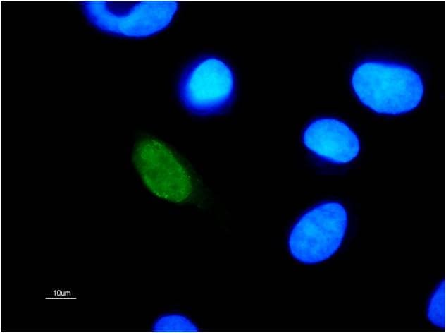 Hpv11 E2 Antibody 10e12 Ab100968  Immunocytochemistry Immunofluorescence Img125062