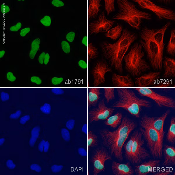 Immunofluorescence staining of HeLa cells showing histone H3 (green), alpha-tubulin (red), and nuclear DNA (blue).