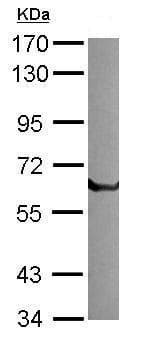 Anti-Tissue Plasminogen Activator antibody(AB227069)