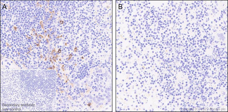 Anti-IL-6 antibody [EPR23819-103](AB290735)