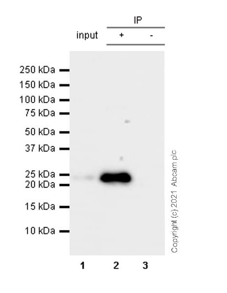 Anti-CBX1 / HP1 beta antibody [EPR24242-78](AB270988)