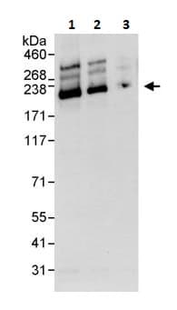 Anti-SMARCA2 / BRM antibody(AB264163)