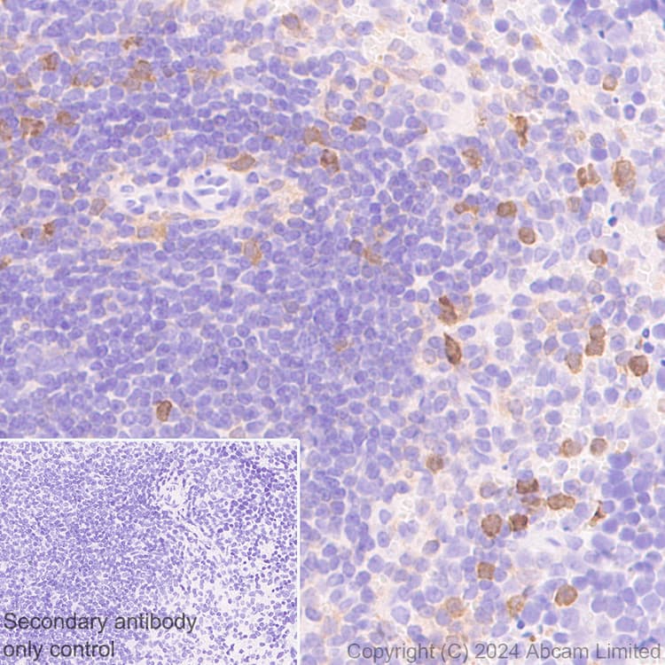 Anti-PADI2 / PAD2 antibody [EPR26940-85](ab322197)