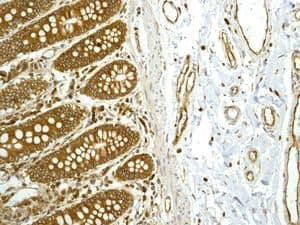 Anti-ADAM15 antibody [EPR5619](AB124698)