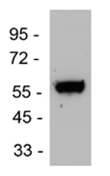 Anti-Endothelin B Receptor/ET-B antibody(AB117529)