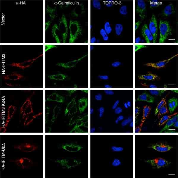 Anti-Calreticulin antibody - ER Marker(AB2907)