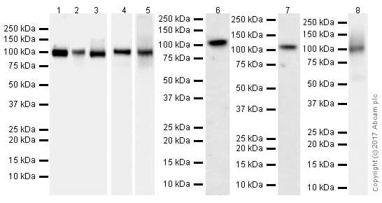 Anti-Hexokinase II antibody [EPR20839](AB209847)