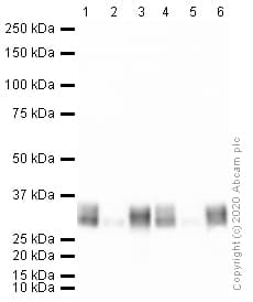 Anti-Mast Cell Tryptase antibody [AA1](ab2378)